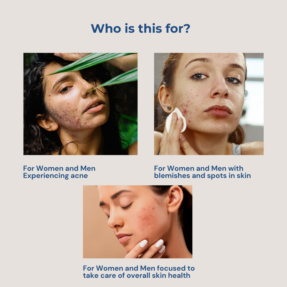 Acne Away Pax
